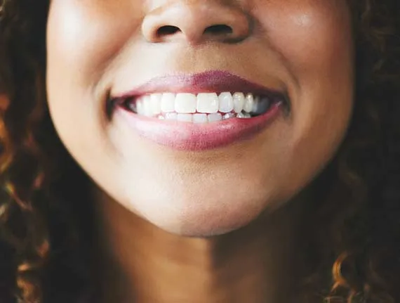 Understanding Veneers: A Journey into Minimally Invasive Dentistry
